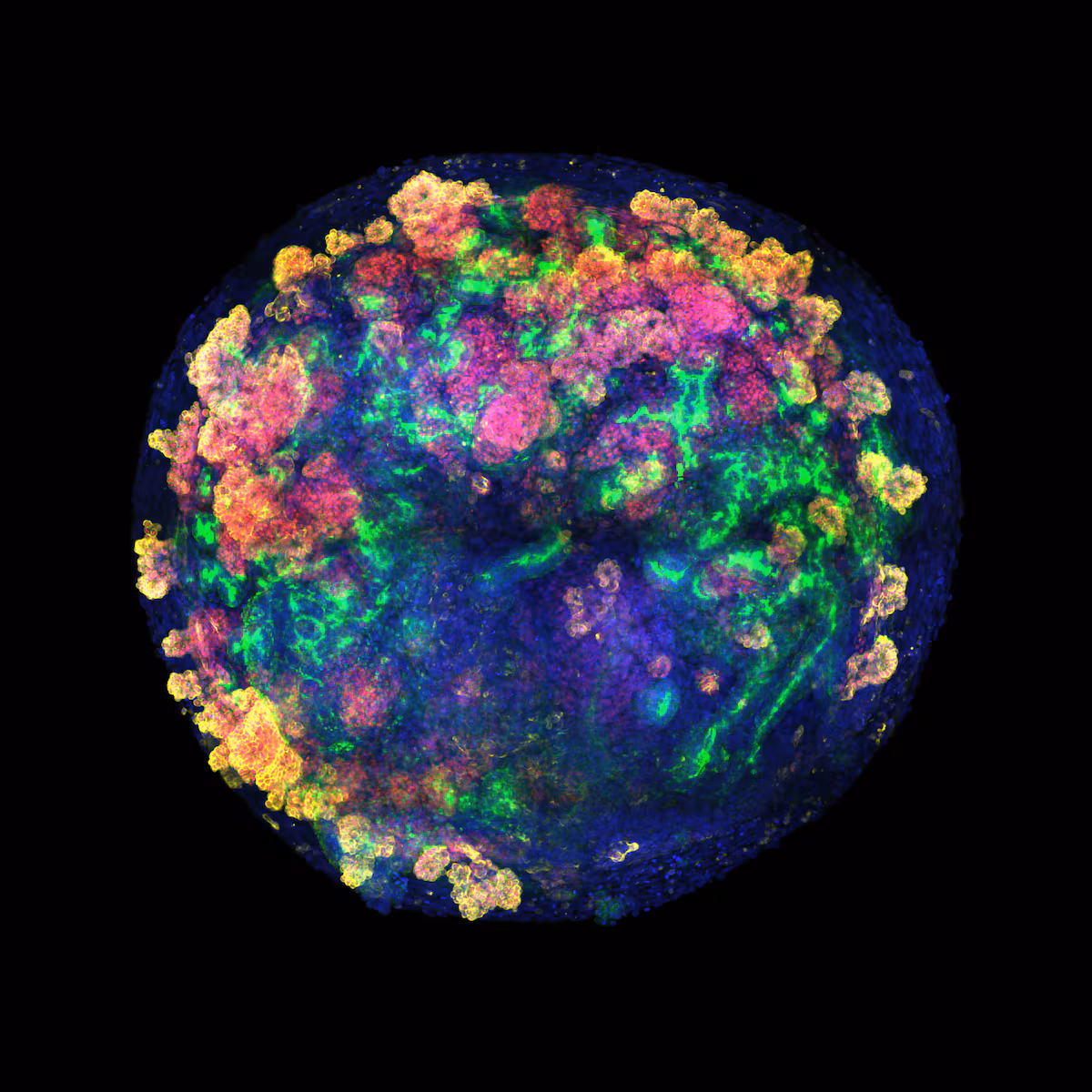 Primer trasplante de minirriñones humanos en cerdos: una esperanza para órganos donados