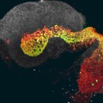 Un Embrión Revela el Misterio de la Primera Semana de Vida Humana