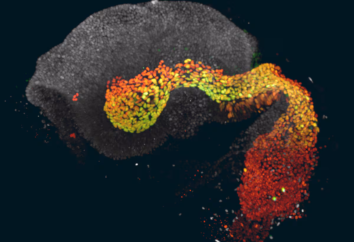 Un Embrión Revela el Misterio de la Primera Semana de Vida Humana