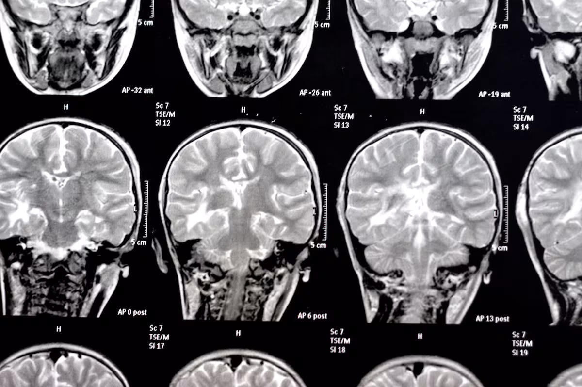 De Borges a Jennifer Aniston: La ciencia revela secretos sobre la memoria